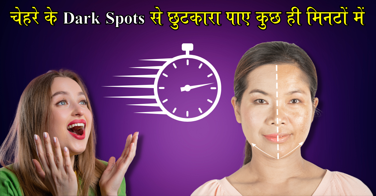 चेहरे के dark spots से छुटकारा पाए कुछ ही मिनटों में